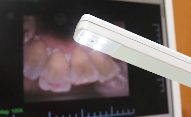 口腔内カメラ・位相差顕微鏡1