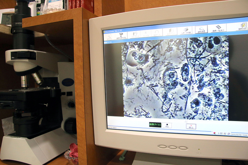 口腔内カメラ・位相差顕微鏡2