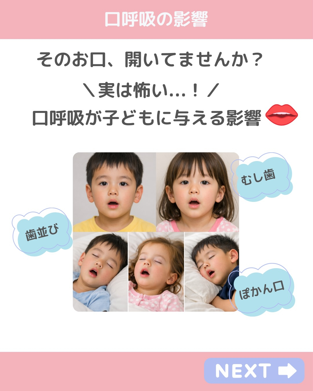 その「お口ポカン」