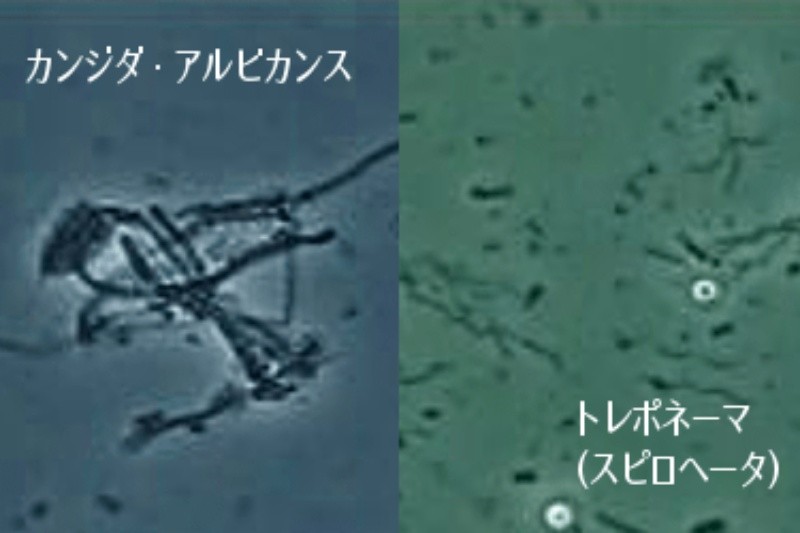 位相差顕微鏡による菌の確認